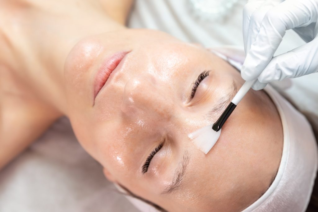 Glow Like Never Before with the Advanced PCA Peel Treatment
